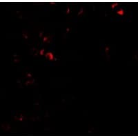 Polyclonal Rabbit anti-Human E2F3 Antibody (IHC, IF, WB)