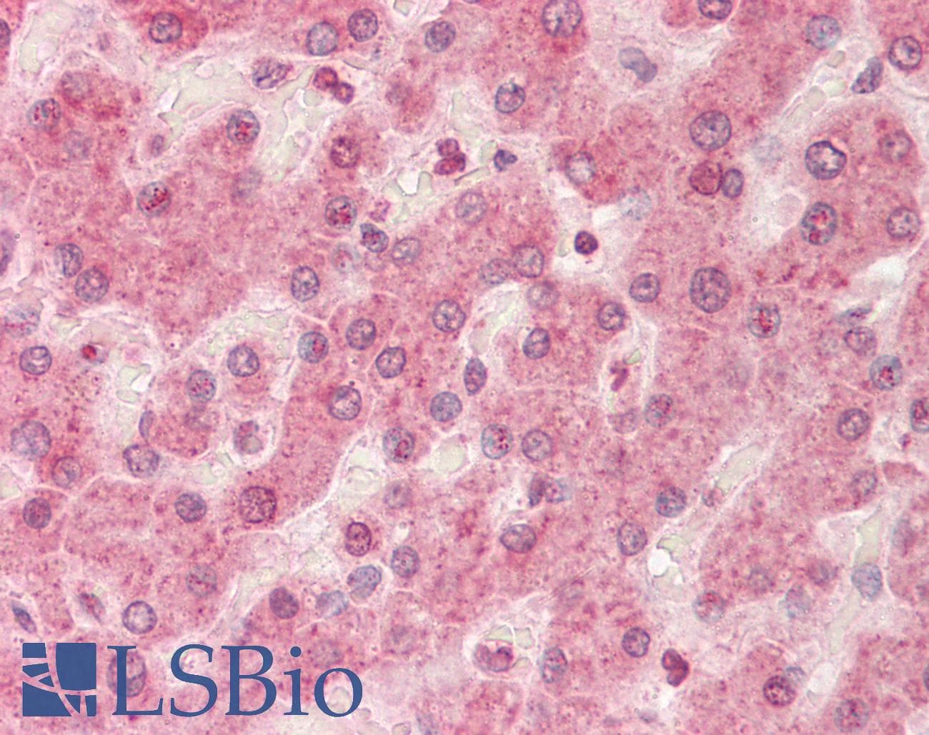 IHC-plus™ LDLR / LDL Receptor Antibody (Internal)