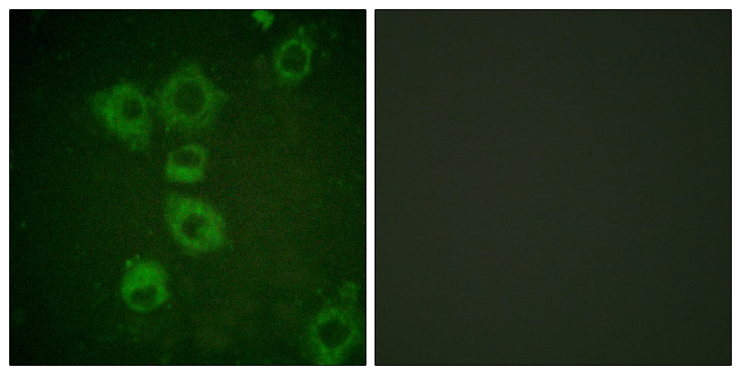 CASP6 / Caspase 6 Antibody (aa223-272)