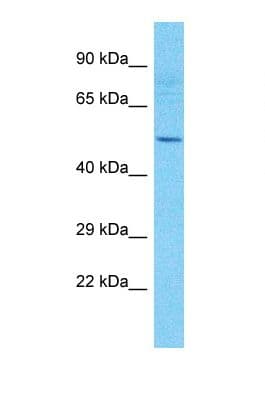 Polyclonal Rabbit anti-Human TMEM151A Antibody (aa163-212, WB)