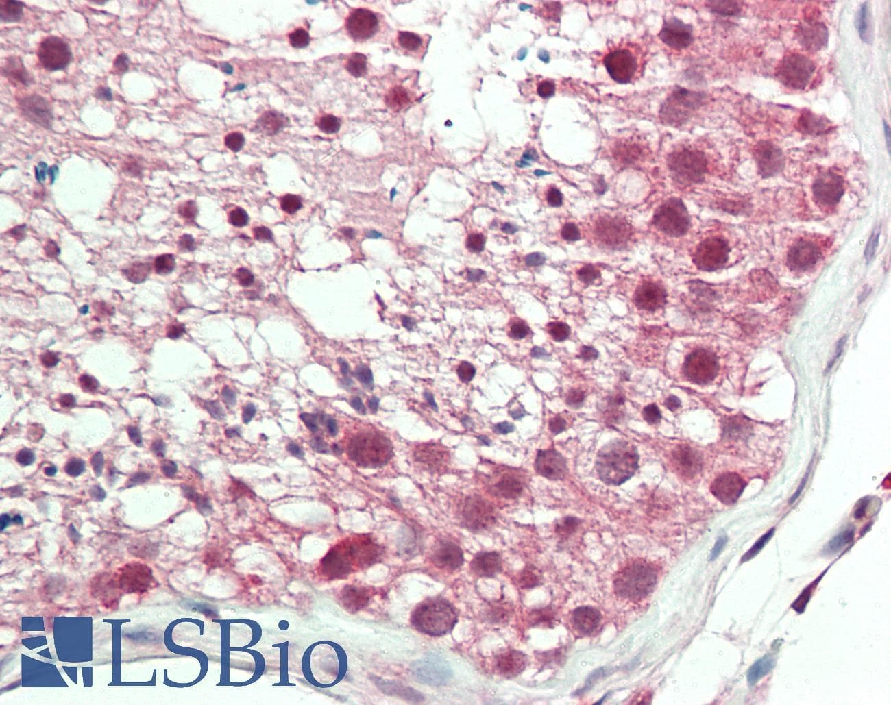 IHC-plus™ Polyclonal Rabbit anti-Human SPON2 / MINDIN Antibody (aa55-104, IHC, WB)
