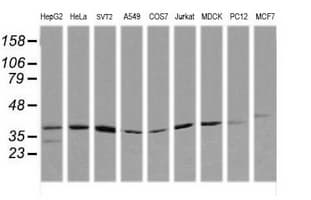 MAP2K3 / MEK3 / MKK3 Antibody (clone OTI1D2, Carrier-free)