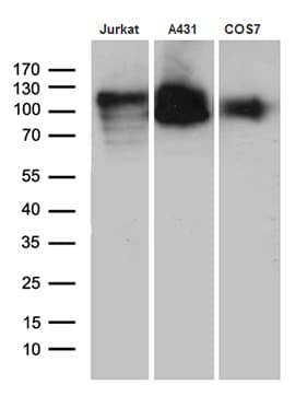 LAMP1 / CD107a Antibody (aa29-382, clone OTI10E1)