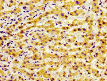 GRK5 Antibody