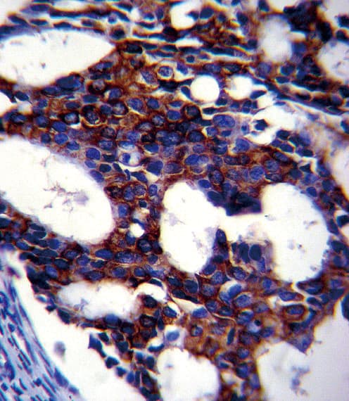 TGFB2 / TGF Beta2 Antibody