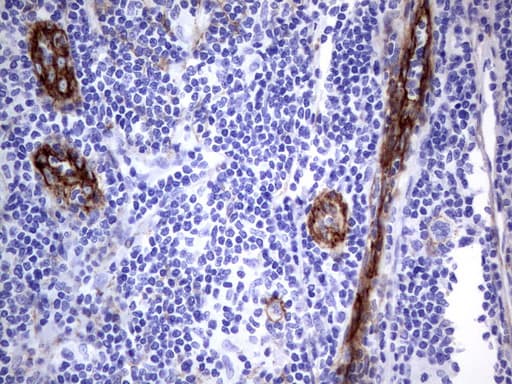 MCAM / CD146 Antibody (clone UMAB154)