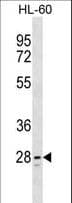Polyclonal Rabbit anti-Human TLCD1 Antibody (aa218-247, WB)