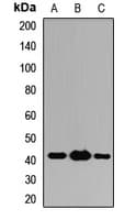 Polyclonal Rabbit anti-Human ST13 Antibody (WB)