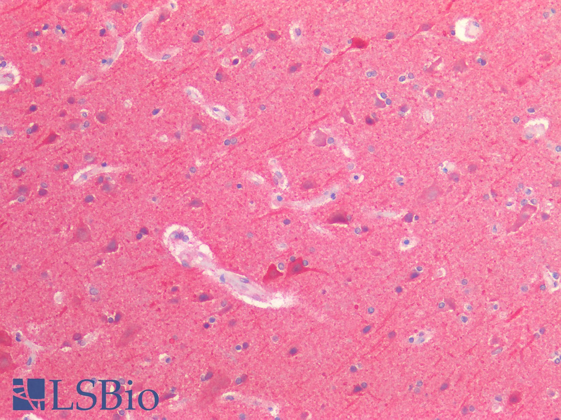 IHC-plus™ Proenkephalin / PENK Antibody