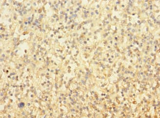 TUBAL3 Antibody