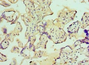 Polyclonal Rabbit anti-Human IGFBP4 Antibody (aa22-258, IHC)