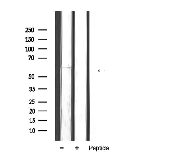 Polyclonal Rabbit anti-Human TGFBR2 Antibody (IHC, WB)