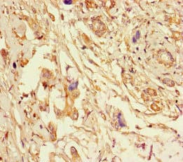 SPFH2 / ERLIN2 Antibody