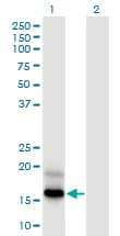 Monoclonal Mouse anti-Human PFDN4 Antibody (clone 2G4, WB)