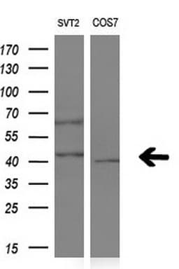 Monoclonal Mouse anti-Human NR1I3 / CAR Antibody (clone OTI1B2, Carrier-free, aa1-236, IHC, WB)