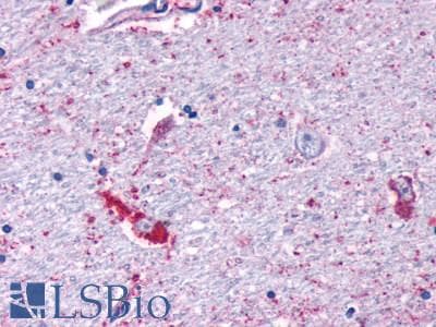 PathPlus™ MRGPRF Antibody (N-Terminus)