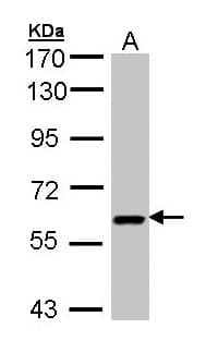 Polyclonal Rabbit anti-Human UAP1 Antibody (aa53-473, IHC, WB)