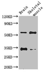 WRB Antibody