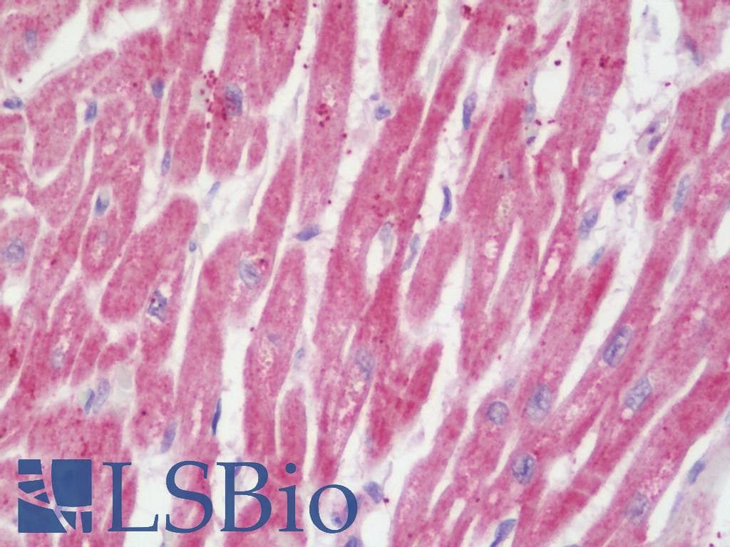 IHC-plus™ NDUFV1 Antibody (aa218-459)