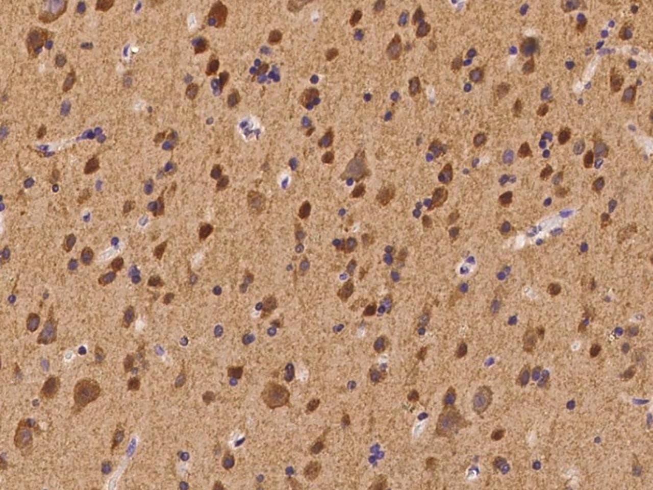 Polyclonal Rabbit anti-Human CACNB4 Antibody (IHC)