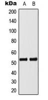 Polyclonal Rabbit anti-Human TP53 / p53 Antibody (phospho-Ser33, WB)