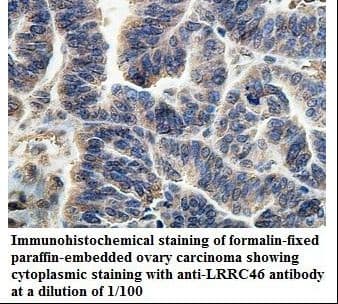 LRRC46 Antibody (aa4-166)