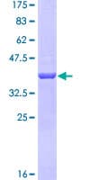 Human ERVWE1 / HERV / Syncytin Protein (Recombinant GST)