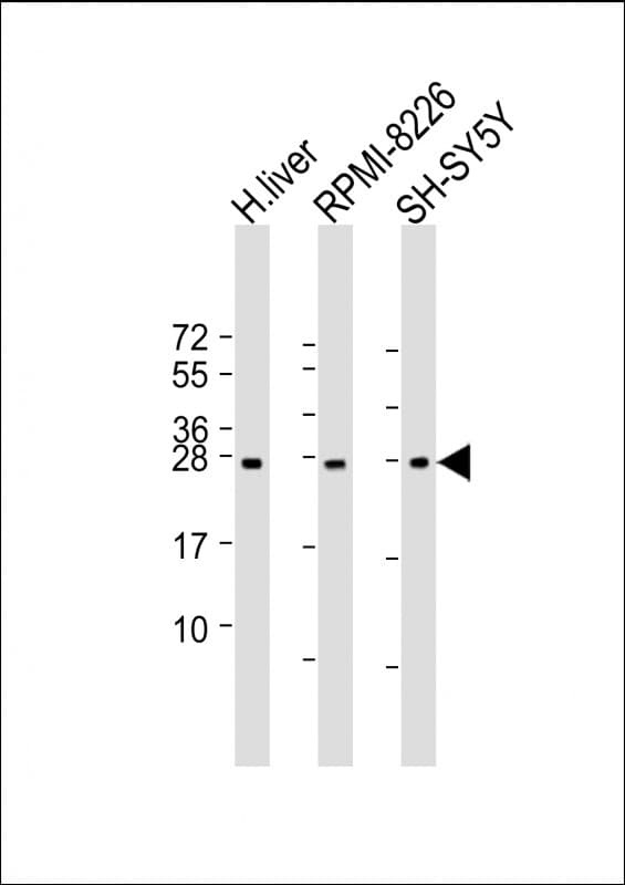 NT5M Antibody (aa195-226)