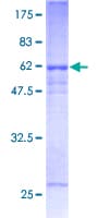 Human IFNGR2 Protein (Recombinant GST)