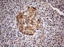 MKI67 / Ki67 Antibody (aa1160-1493, clone OTI5E6)