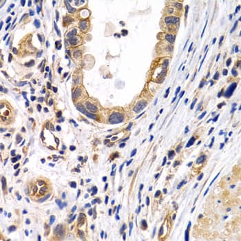 PTGIR / IP Receptor Antibody