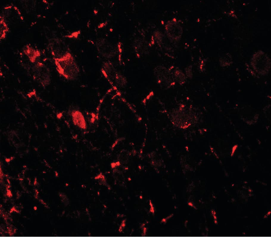 IHC-plus™ Polyclonal Rabbit anti-Human ULK1 Antibody (IHC, IF, WB)