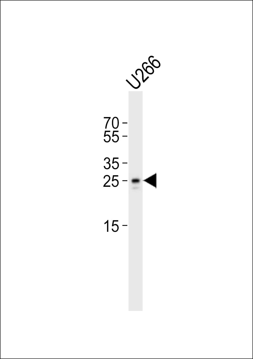TRBC1 Antibody (aa104-136)