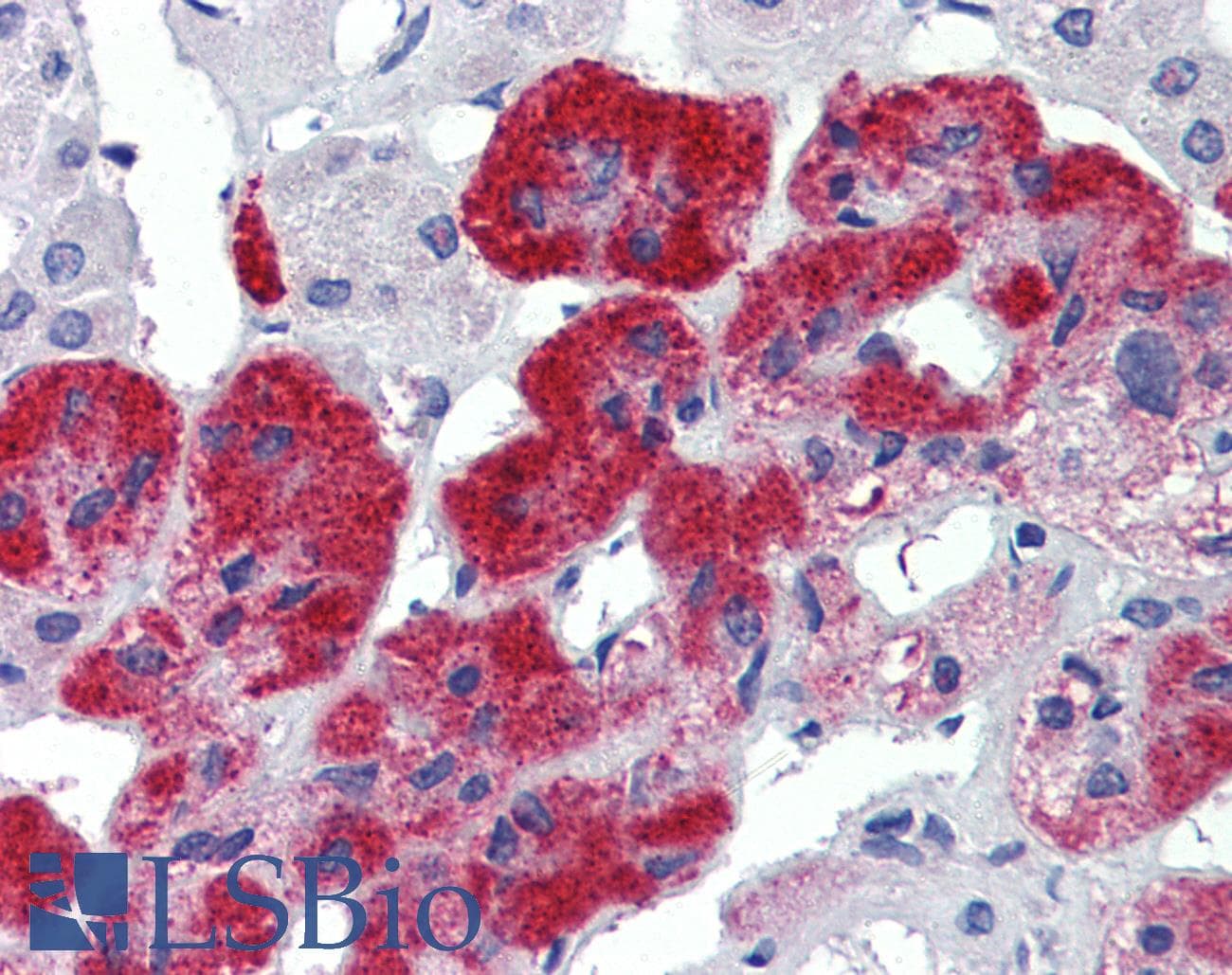 IHC-plus™ JPH3 Antibody
