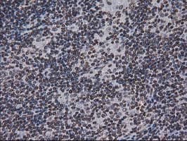 CTDSP1 / SCP1 Antibody (clone OTI1B6)