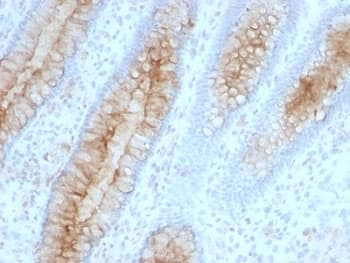 B2M / Beta 2 Microglobulin Antibody (clone B2M/961, Ready-to-Use)