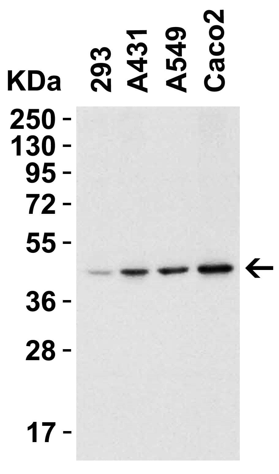 IHC-plus™ Polyclonal Rabbit anti-Human CerS6 / LASS6 Antibody (IHC, IF, WB)