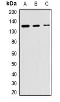 Polyclonal Rabbit anti-Human SKIV2L2 Antibody (IHC, WB)