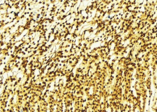 MAP2K1 / MKK1 / MEK1 Antibody