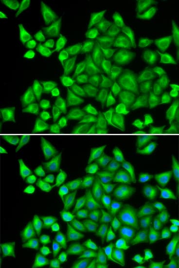 IHC-plus™ DHRS9 Antibody