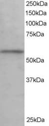 IHC-plus™ KPNA3 / Importin Alpha 4 Antibody (aa509-521)