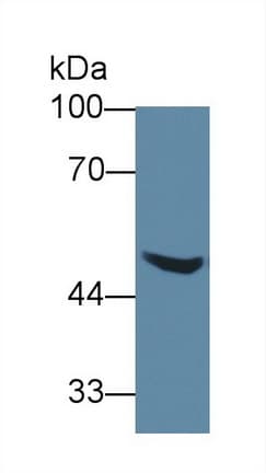 AGXT2 Antibody (HRP)