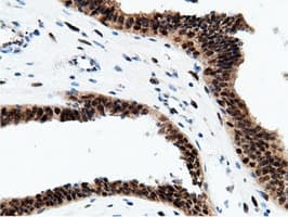 EPM2AIP1 Antibody (clone OTI2G3)