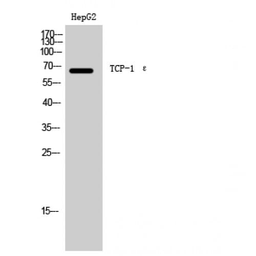 Polyclonal Rabbit anti-Human CCT5 / TCP1 Epsilon Antibody (210-290 aa, Internal, WB)