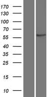 CAMK2B / CaMKII Beta Protein (Over-Expression Lysate Myc-DDK (Flag))