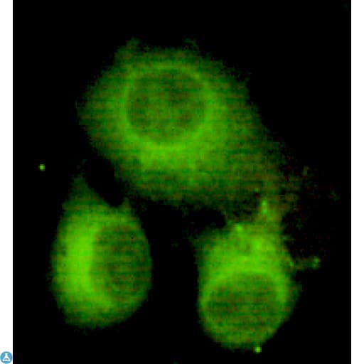 Monoclonal Mouse anti-Human ACLY / ATP Citrate Lyase Antibody (WB)