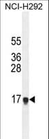 HEPN1 Antibody (aa6-34)