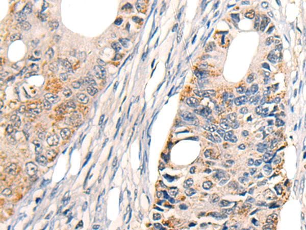 TRAIL-R4 / DCR2 Antibody