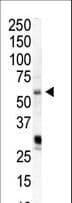 Polyclonal Rabbit anti-Human PIP5K1A Antibody (aa19-50, WB)
