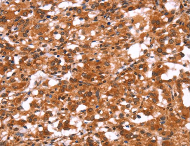 GABRA1 Antibody